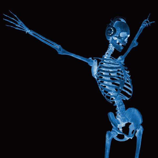 اسکلت دی جی در آزادی اشعه ایکس