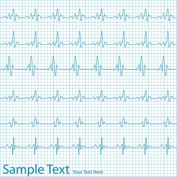 تصویر شکل موج در نمودار ECG بررسی شده