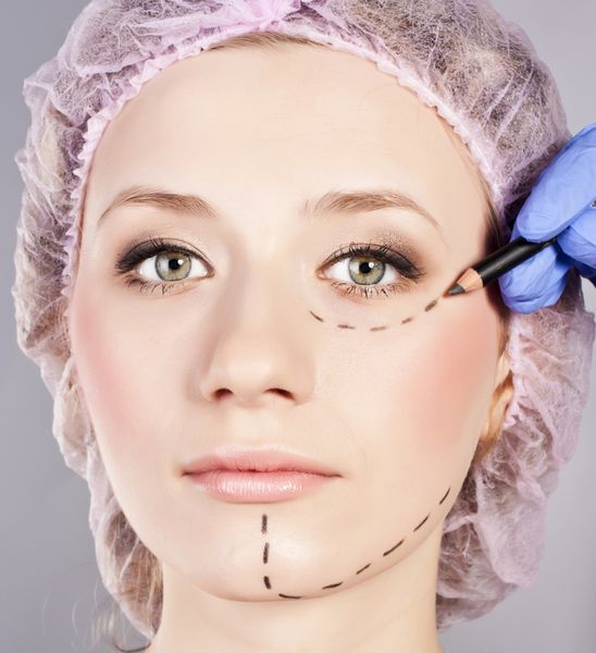 خطوط کشیده روی صورت زن نشانه هایی برای جراحی پلاستیک صورت