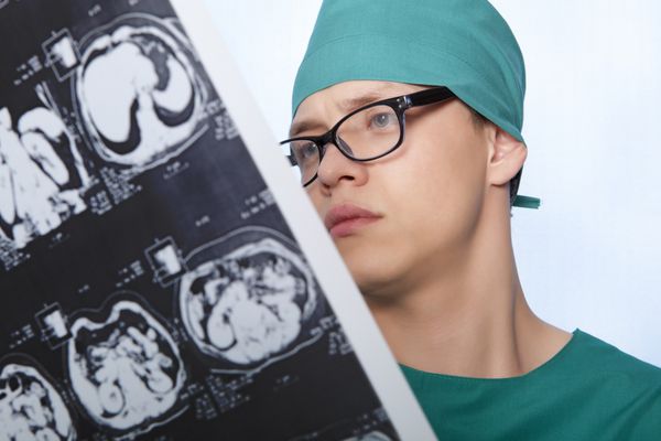 پزشک مرد تصویر اشعه ایکس مغز انسان را بررسی می کند