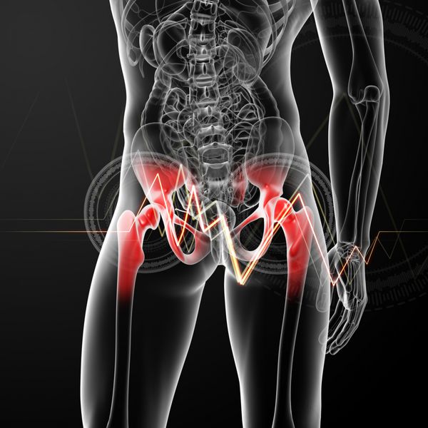 رندر سه بعدی تصویر پزشکی از مفصل دردناک لگن - نمای پشت