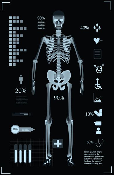 قالب اینفوگرافیک پزشکی به سبک X Ray