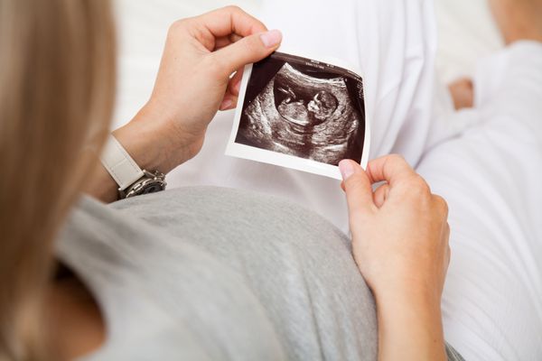 زن باردار به سونوگرافی از نوزاد نگاه می کند از نزدیک از اسکن