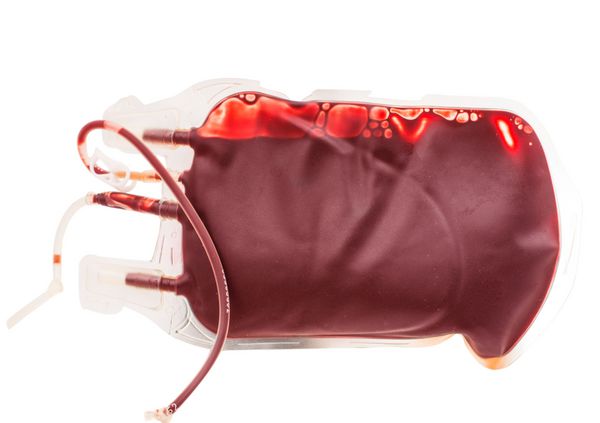 کیسه خون و پلاسما جدا شده در پس زمینه سفید