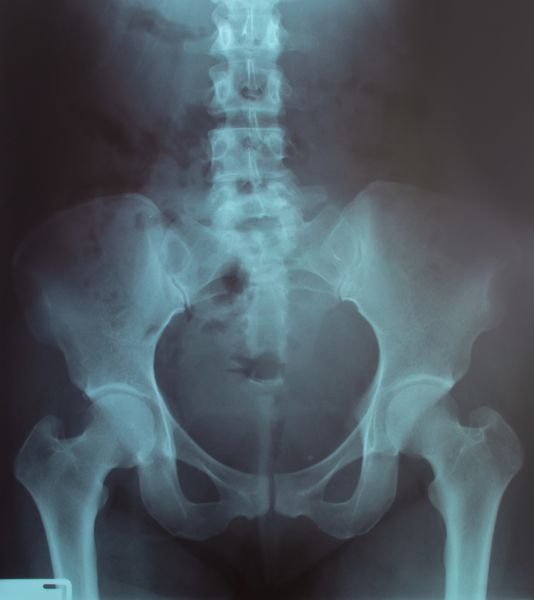 تصویر اشعه ایکس از انسان برای تشخیص پزشکی