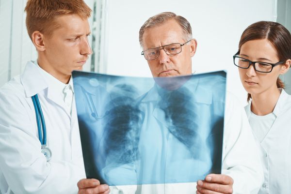 دکتر مرد ارشد و پزشکان جوان تصویر اشعه ایکس از ریه ها را در یک کلینیک بررسی می کنند