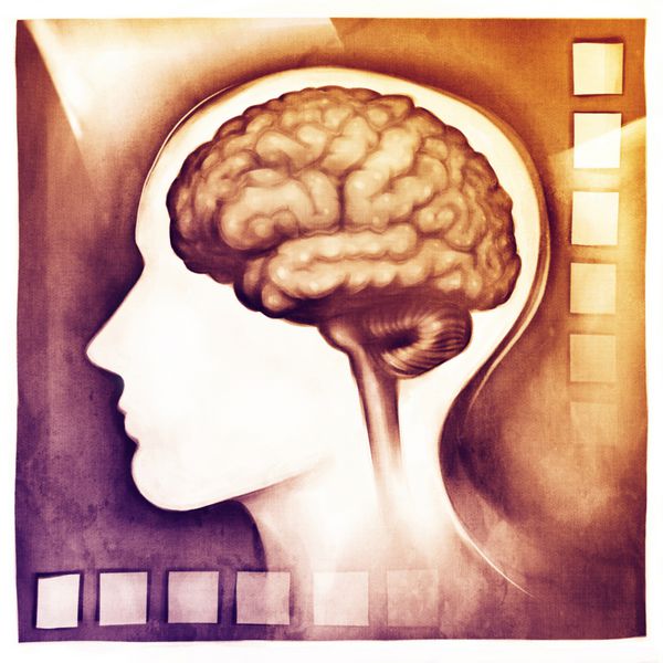 سر سبک شده مغز انسان تصویر ساده شماتیک پزشکی - نقاشی