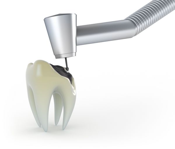درمان دندان با پوسیدگی