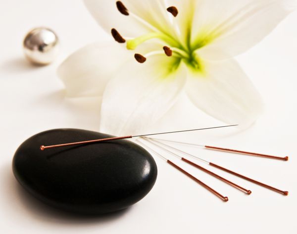 Akupunktur und Massage