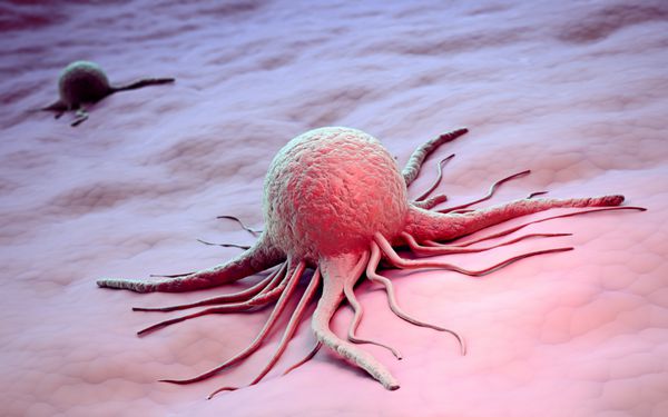 تصویر علمی سلول سرطانی