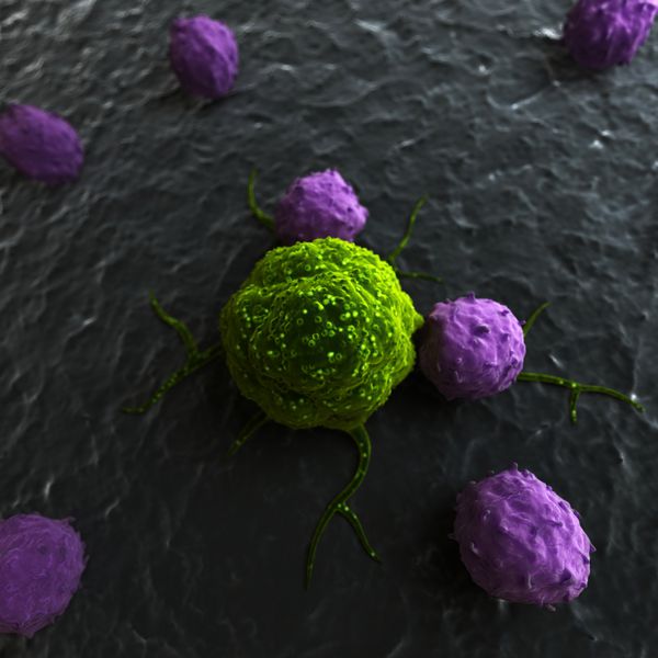 تصویر سه بعدی از حمله لکوسیت ها به سلول سرطانی