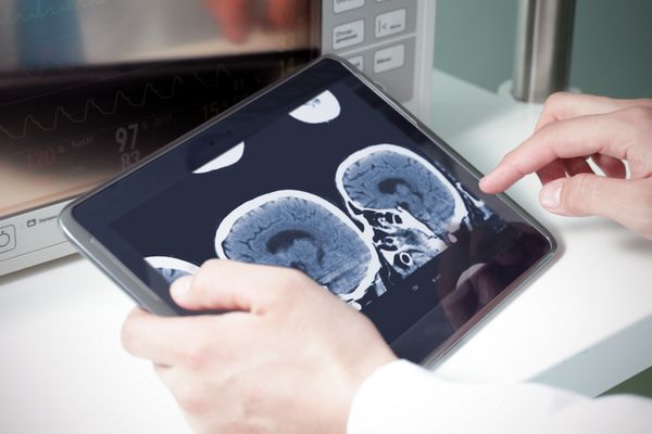دکتر در حال بررسی اسکن مغز گربه روی یک تبلت دیجیتال