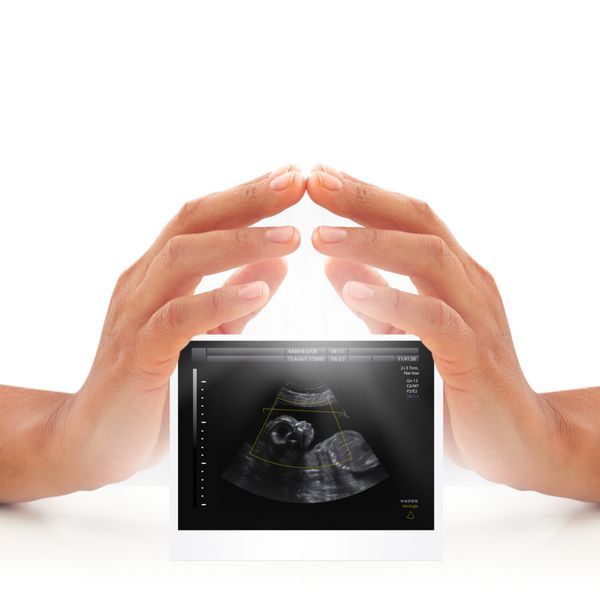زن سونوگرافی نوزاد را در شکم مادر تحویل می دهد بارداری