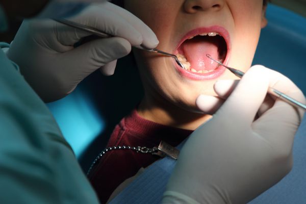 مراقبت از دندان برای یک کودک