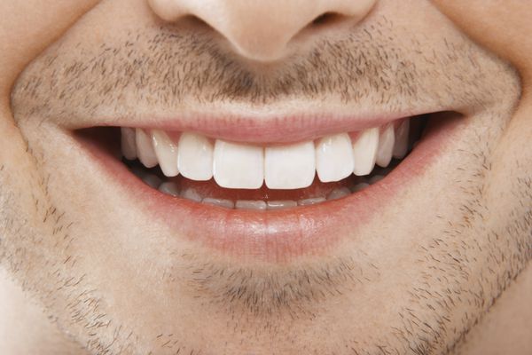 تصویری دقیق از مرد جوان در حال لبخند زدن با دندان های سفید کامل