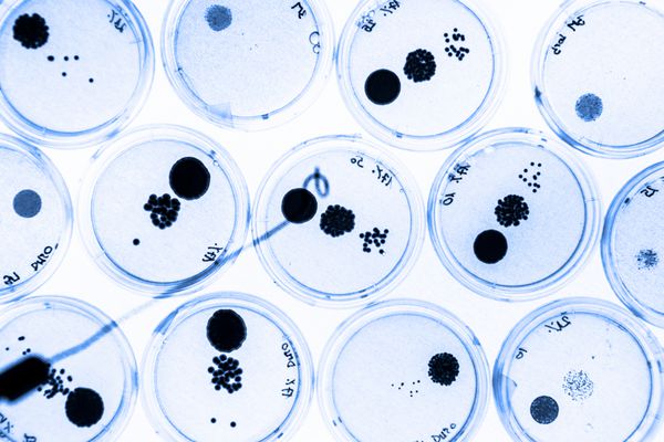 رشد باکتری در ظروف پتری روی ژل آگار به عنوان بخشی از آزمایش علمی