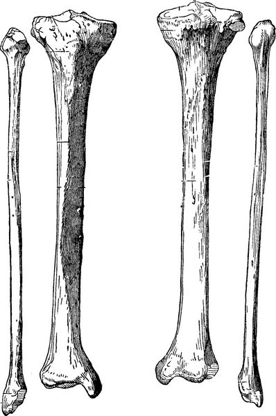 استخوان های ساق پا درشت نی و نازک نی تصویر حکاکی شده قدیمی فرهنگ لغت پزشکی ایالات متحده توسط دکتر لث - 1885