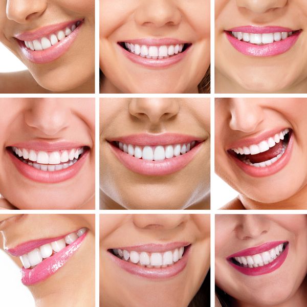 خندان افراد شاد با دندان های سالم سلامت دندان کلاژ