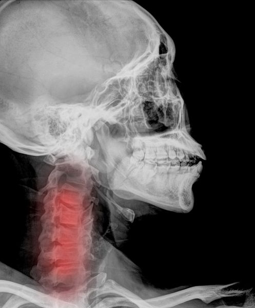 اشعه ایکس گردن دردناک