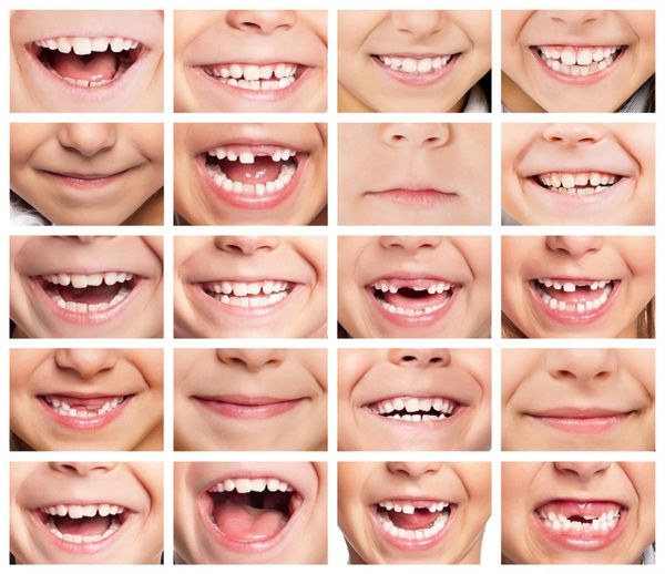 fs بچه های خندان مجموعه ای از لبخند کودکان دندان های سالم لبخند