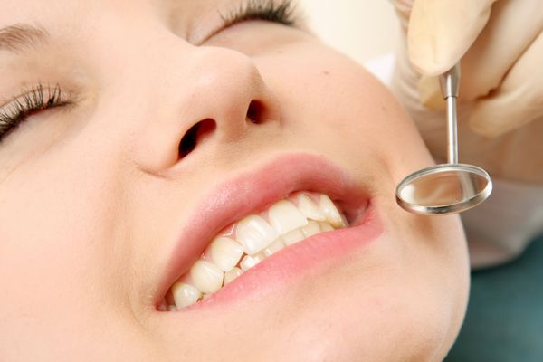 دندان های زن سالم و آینه دهان دندانپزشک