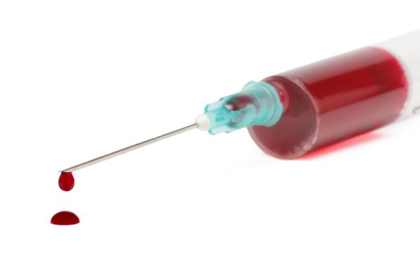 خون استخراج شده در سرنگ با سوزن زیرپوستی قطرات خون در زمینه سفید جدا شده