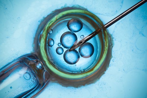 تحقیقات میکروسکوپی آزمایشگاهی یا مفهوم ماکرو IVF