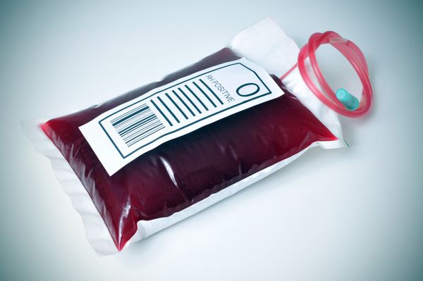 نمای نزدیک از یک کیسه خون با برچسبی با متن o rh مثبت با یک خط مشی کوچک اضافه شده است