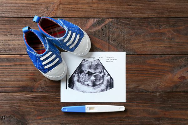 عکس سونوگرافی نوزاد تست بارداری و کفش بچه گانه در زمینه چوبی