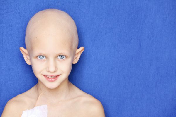 پرتره یک کودک قفقازی بدون مو به دلیل شیمی درمانی