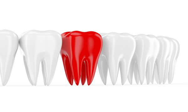 دندان درد در ردیف دندان های سالم 3 بعدی