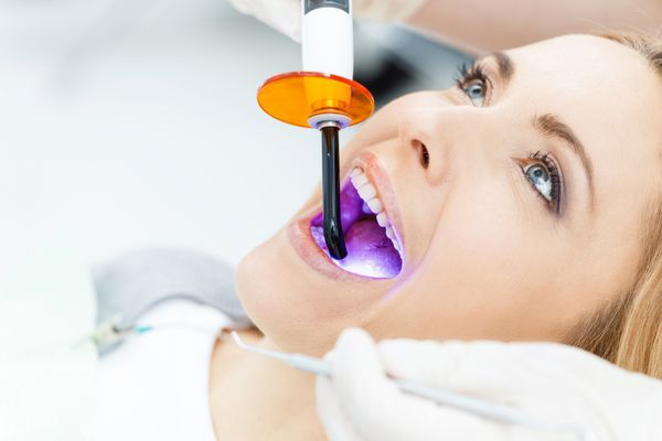 نمای نزدیک از دندانپزشک با استفاده از لامپ UV کیورینگ دندان روی دندان های بیمار