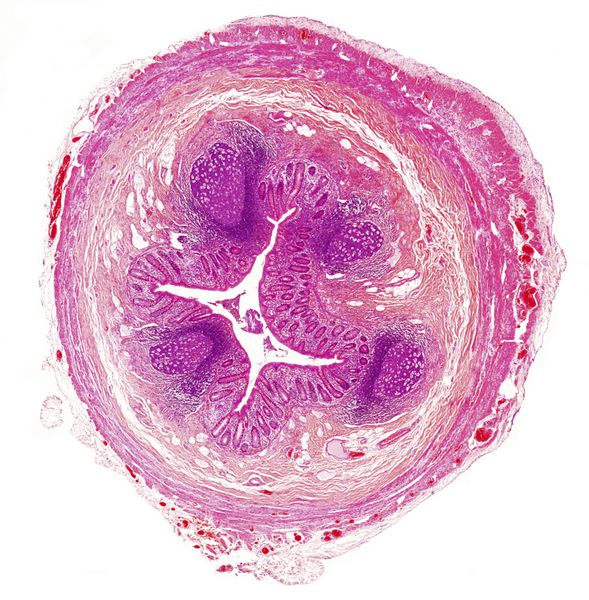 تصویر میکروسکوپی از آپاندیس انسان
