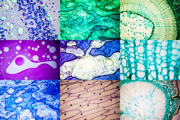 مجموعه علمی مقطع میکروسکوپی بافت عکس های واقعی پوسی