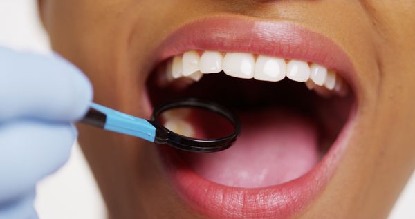 نمای نزدیک از زن سیاهپوست خندان در دندانپزشک