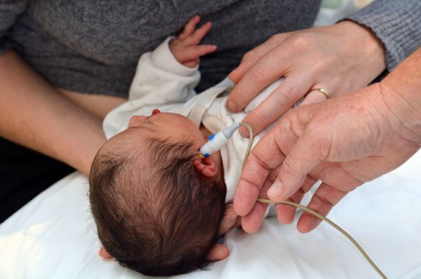 اوکلند - 9 ژوئن 2014 نوزاد تازه متولد شده سن نائومی بن آری 0 در طول غربالگری شنوایی کم شنوایی قابل توجه شایع ترین اختلال در بدو تولد است تقریباً 1 تا 2 درصد نوزادان مبتلا به این بیماری هستند
