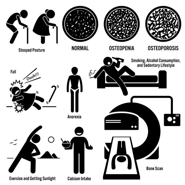 علائم پوکی استخوان پیرزن پیرزن عوامل خطر پیشگیری تشخیص استیک شکل نمادهای پیکتوگرام