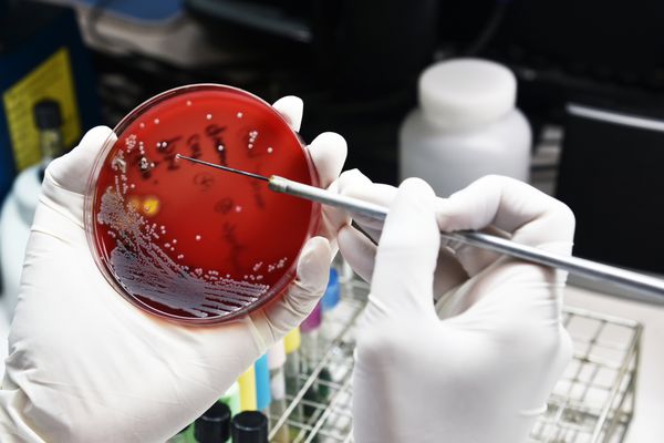 بستن صفحه رسانه در تکنسین های پزشکی دستکاری که بر روی کشت باکتری ها و مقاومت به داروهای پاتوژن در آزمایشگاه کار می کنند؛ شناسایی باکتری ها