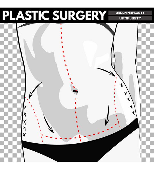 جراحی پلاستیک تصویر برداری