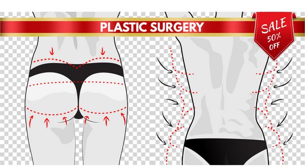 جراحی پلاستیک تصحیح بدن جدا شده بردار تصویر