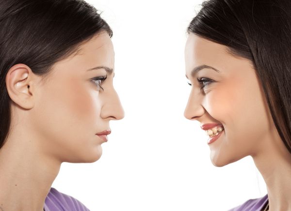 صورت زن قبل و بعد از جراحی زیبایی بینی