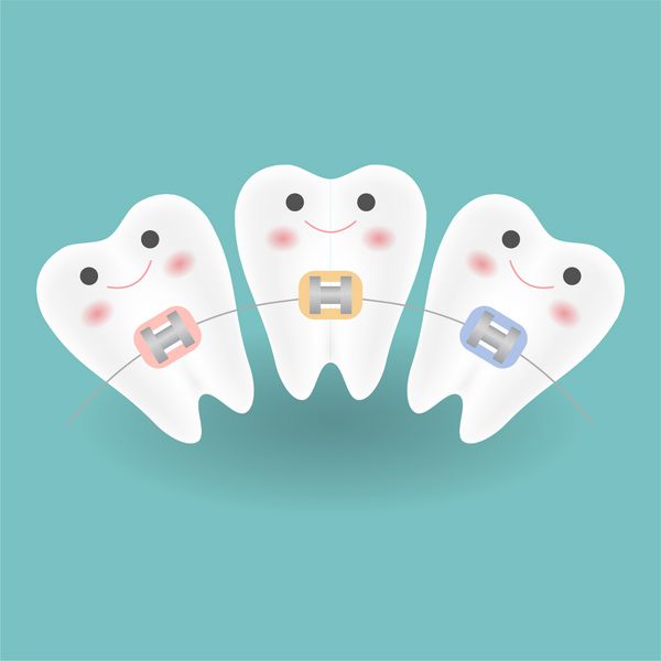 دندان های سفید لبخند زیبا در هنگام مصرف ارتودنسی با ابزار دندان احساس خوشحالی می کنند