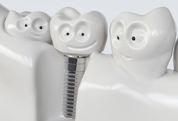 کاشت کارتون انسان دندان 3D Rendering