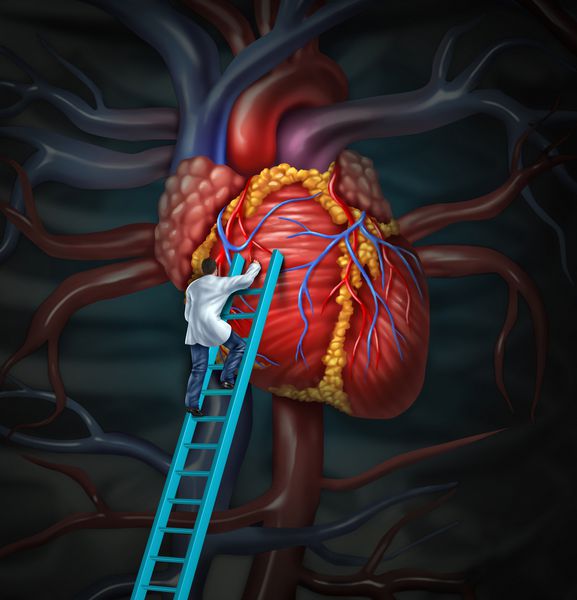 پزشک قلب قلب مراقبت های بهداشتی و مفهوم پزشکی را با جراح یا متخصص قلب در حال بالا رفتن از نردبان برای نظارت و بازرسی از آناتومی قلبی عروقی انسان برای معالجه تشخیص بیمارستانی انجام می دهد