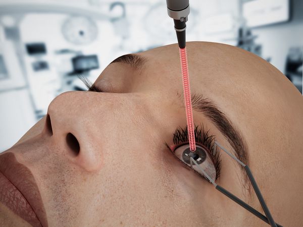 جراحی چشم با لیزر بر روی شخصیت CGI 3D