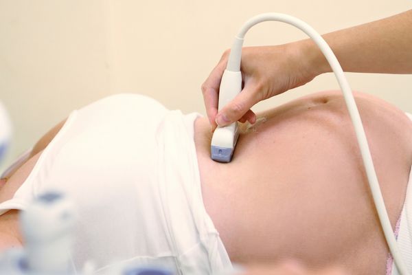زن باردار تشخیصی سونوگرافی