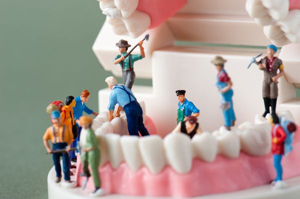 مردم برای ترمیم دندان