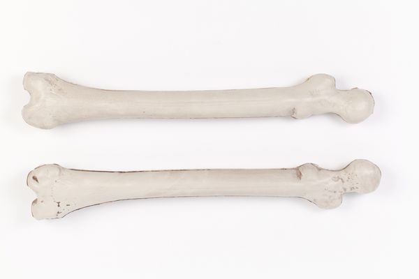 استخوان ارتوپدی جدا شده بر روی زمینه سفید