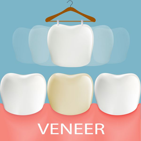 روکش های دندانپزشکی آناتومی دندان تصویر برداری سهام