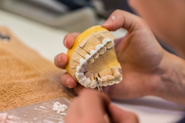 تولید دندانهای کاشت دندان